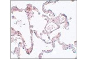 Immunohistochemistry of PLEKHM1 in human lung tissue with this product at 5 μg/ml. (PLEKHM1 抗体  (N-Term))