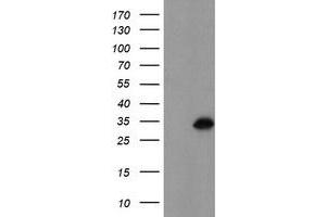 Western Blotting (WB) image for anti-Myeloid Leukemia Factor 1 (MLF1) antibody (ABIN1499495) (MLF1 抗体)