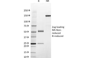 SDS-PAGE Analysis Purified STAT3 Mouse Monoclonal Antibody (STAT3/2409). (STAT3 抗体)