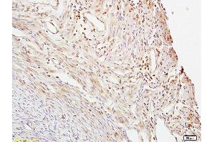 Formalin-fixed and paraffin embedded mouse uterus labeled with Anti- CTBP1 Polyclonal Antibody, Unconjugated (ABIN686152) at 1:200 followed by conjugation to the secondary antibody and DAB staining. (CTBP1 抗体  (AA 351-440))