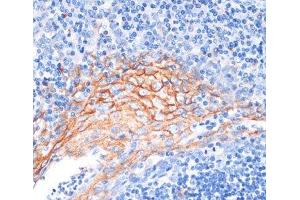 Immunohistochemistry of paraffin-embedded Human tonsil using AREG Polyclonal Antibody at dilution of 1:100 (40x lens). (Amphiregulin 抗体)