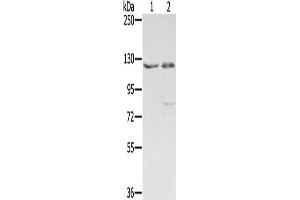 Gel: 6 % SDS-PAGE, Lysate: 40 μg, Lane 1-2: 293T cells, hela cells, Primary antibody: ABIN7192565(SMC6 Antibody) at dilution 1/400, Secondary antibody: Goat anti rabbit IgG at 1/8000 dilution, Exposure time: 1 minute (SMC6 抗体)