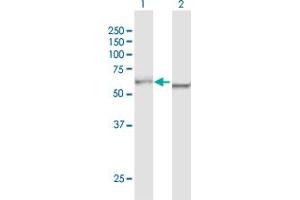 Western Blot analysis of DDX5 expression in transfected 293T cell line by DDX5 MaxPab polyclonal antibody. (DDX5 抗体  (AA 1-614))