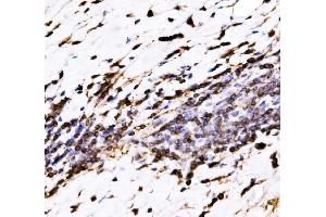 IHC analysis of EVL using anti-EVL antibody (ABIN7600986). (EVL 抗体  (AA 268-400))