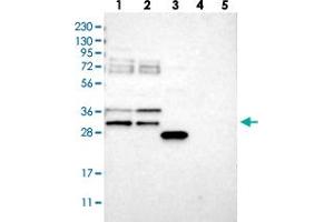 Western blot analysis of Lane 1: RT-4, Lane 2: U-251 MG, Lane 3: Human Plasma, Lane 4: Liver, Lane 5: Tonsil with RBM7 polyclonal antibody  at 1:250-1:500 dilution. (RBM7 抗体)