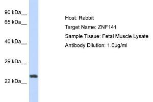 Host: Rabbit Target Name: ZNF732 Sample Tissue: Human Fetal Muscle Antibody Dilution: 1ug/ml (ZNF141 抗体  (N-Term))