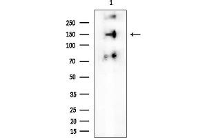 Western blot analysis of lysates from MCF7 cells, using NMDAR2B Mouse Monoclonal Antibody at 1/1000 dilution.