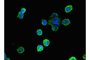 Immunofluorescent analysis of MCF-7 cells using ABIN7154080 at dilution of 1:100 and Alexa Fluor 488-congugated AffiniPure Goat Anti-Rabbit IgG(H+L) (Glutathione Reductase 抗体  (AA 47-219))