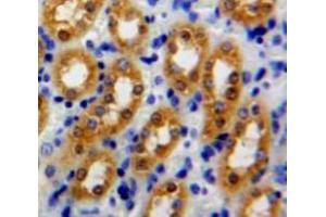IHC-P analysis of Kidney tissue, with DAB staining. (Peroxiredoxin 5 抗体  (AA 1-162))