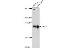 Western Blotting (WB) image for anti-Deoxyribonuclease I (DNASE1) (AA 22-282) antibody (ABIN3016215)