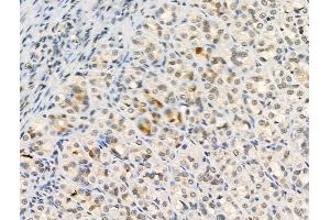 Phospho-Hsp90 alpha (Tyr627) Antibody at 1/100 staining Rat stomach tissue by IHC-P.