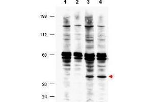 Western blot using  affinity purified anti-FANCF antibody shows detection of FANCF present in a lysate prepared from a Fanconi anemia complementation group F patient lymphoblast after retroviral correction using hFANCF cDNA (lanes 3 and 4). (FANCF 抗体  (Internal Region))