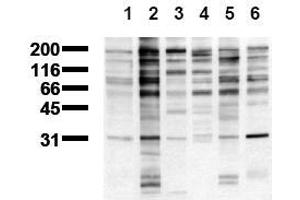 Western Blotting (WB) image for anti-Phosphotyrosine antibody (ABIN126879) (Phosphotyrosine 抗体)