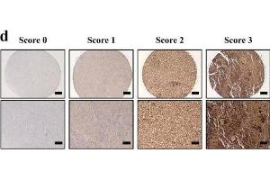 Immunohistochemistry (IHC) image for anti-Chemokine (C-X-C Motif) Receptor 7 (CXCR7) antibody (ABIN2857021)