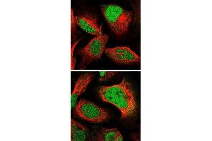 Immunofluorescent staining of human cell line U-2 OS with PPP1R26 polyclonal antibody  at 1-4 ug/mL dilution shows positivity in nucleus. (PPP1R26 抗体)