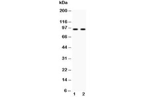 Western blot testing of Cadherin 17 antibody and Lane 1:  HeLa (LI Cadherin 抗体  (AA 686-699))