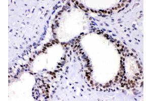 Immunohistochemistry (IHC) image for anti-Activated RNA Polymerase II Transcriptional Coactivator p15 (SUB1) (AA 96-127), (C-Term) antibody (ABIN4886733)