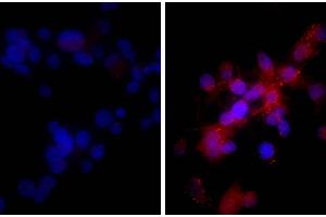 Human hepatocellular carcinoma cell line Hep G2 was stained with Rabbit IgG-UNLB isotype control, and DAPI. (TNFRSF10B 抗体)