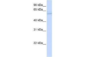 WB Suggested Anti-ND5 Antibody Titration:  0. (MT-ND5 抗体  (N-Term))