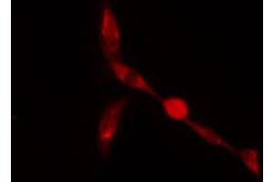 ABIN6274261 staining A549 cells by IF/ICC. (ZFP36L2 抗体  (Internal Region))