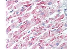 Image no. 1 for anti-Amyloid beta (Abeta) (AA 1-14), (N-Term) antibody (ABIN401205) (beta Amyloid 抗体  (N-Term))