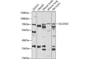 Western blot analysis of extracts of various cell lines, using SLC23 antibody (ABIN6133021, ABIN6147898, ABIN6147899 and ABIN6222467) at 1:1000 dilution. (SLC23A2 抗体  (AA 1-90))