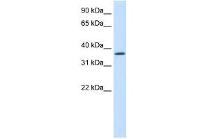 WB Suggested Anti-SAP30BP Antibody Titration:  1. (SAP30BP 抗体  (C-Term))