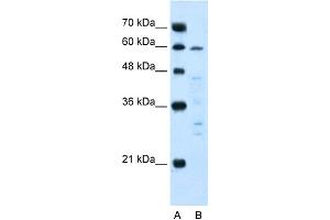 WB Suggested Anti-IL10RA Antibody Titration:  5. (IL-10RA 抗体  (N-Term))