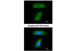 ICC/IF Image Immunofluorescence analysis of paraformaldehyde-fixed HeLa, using B-cell linker protein, antibody at 1:200 dilution. (B-Cell Linker 抗体  (C-Term))