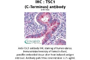 Image no. 2 for anti-Tuberous Sclerosis 1 (TSC1) (C-Term) antibody (ABIN1740408) (TSC1 抗体  (C-Term))