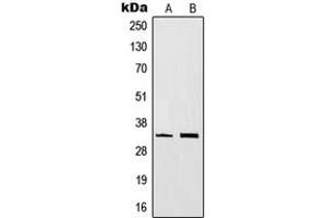Western blot analysis of CD20 expression in BJAB (A), Ramos (B) whole cell lysates. (CD20 抗体  (C-Term))