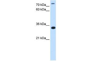WB Suggested Antibody Titration:  2. (TAM41 抗体  (N-Term))