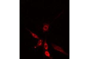 Immunofluorescence (fixed cells) (IF/ICC) image for anti-Solute Carrier Family 30 (Zinc Transporter), Member 9 (SLC30A9) (Internal Region) antibody (ABIN6258368)