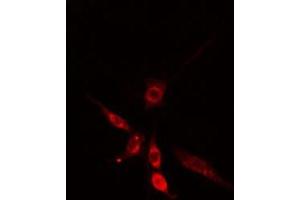 ABIN6275698 staining  HepG2 cells by IF/ICC. (SLC30A9 抗体  (Internal Region))