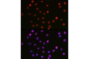 Immunofluorescence analysis of C6 cells using [KO Validated] Acetyl-HMGB1-K29 Rabbit pAb (ABIN7267647) at dilution of 1:100 (40x lens). (HMGB1 抗体  (acLys29))