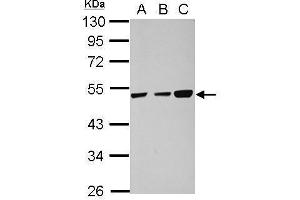 WB Image Sample (30 ug of whole cell lysate) A: 293T B: HeLa C: HepG2 10% SDS PAGE antibody diluted at 1:1000 (TXNDC5 抗体)
