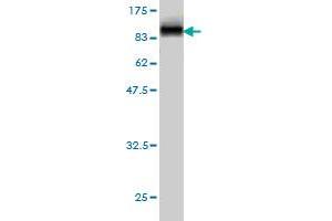 Western Blot detection against Immunogen (89. (Radixin 抗体  (AA 1-583))
