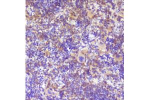 IHC analysis of RP2 using anti-RP2 antibody (ABIN6719513).