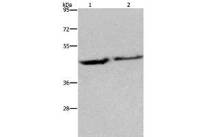 Western Blot analysis of Human adrenal pheochromocytoma and fetal brain tissue using EIF3H Polyclonal Antibody at dilution of 1:1150 (EIF3H 抗体)