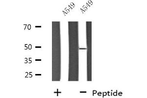 Western blot analysis of extracts from A549 cells, using SLC30A4 antibody.