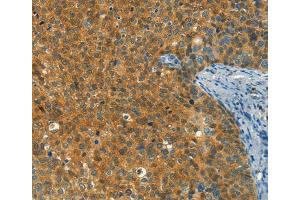 Immunohistochemistry (IHC) image for anti-DIRAS Family, GTP-Binding RAS-Like 1 (DIRAS1) antibody (ABIN2432953) (DIRAS1 抗体)