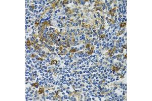 Immunohistochemistry of paraffin-embedded human tonsil using HSPH1 antibody. (HSPH1 抗体  (AA 659-858))