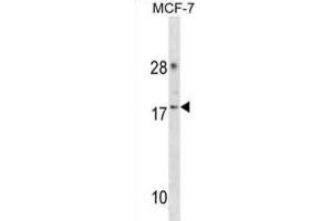 Western Blotting (WB) image for anti-Cyclin-Dependent Kinase 2 Associated Protein 2 (CDK2AP2) antibody (ABIN3000904) (CDK2AP2 抗体)