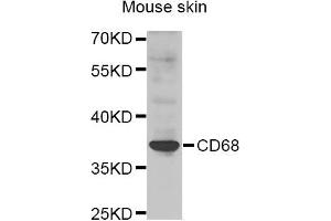 Western blot analysis of extracts of Mouse skin cell line, using CD68 antibody.