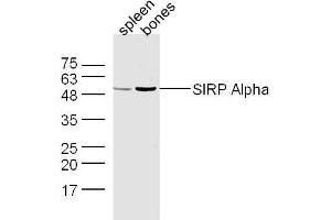 Mouse spleen and bone lysates probed with Rabbit Anti-SIRP Alpha Polyclonal Antibody, Unconjugated  at 1:500 for 90 min at 37˚C. (SIRPA 抗体  (AA 151-250))
