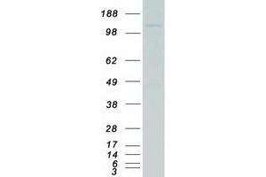 Western Blotting (WB) image for alpha-Kinase 1 (ALPK1) (Transcript Variant 1) protein (Myc-DYKDDDDK Tag) (ABIN2714634)