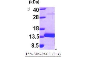 Myotrophin (MTPN) (AA 1-118) protein (His tag)