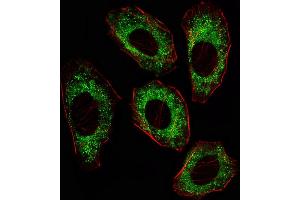 Fluorescent image of A549 cell stained with SRC Antibody (ABIN387822 and ABIN2843908)/SD41014A. (Src 抗体)