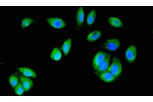 Immunofluorescent analysis of A549 cells using ABIN7146988 at dilution of 1:100 and Alexa Fluor 488-congugated AffiniPure Goat Anti-Rabbit IgG(H+L) (CTNND1 抗体  (AA 482-605))