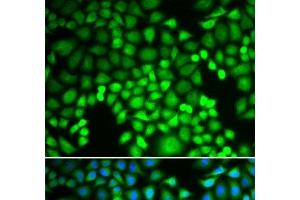 Immunofluorescence analysis of U2OS cells using PSMA4 Polyclonal Antibody (PSMA4 抗体)